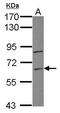 Zinc Finger Protein 282 antibody, PA5-31276, Invitrogen Antibodies, Western Blot image 