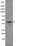 Death Associated Protein Kinase 1 antibody, PA5-64779, Invitrogen Antibodies, Western Blot image 