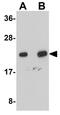 NADH:Ubiquinone Oxidoreductase Subunit B9 antibody, GTX85007, GeneTex, Western Blot image 