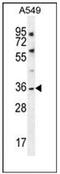 TWIK1 antibody, AP52313PU-N, Origene, Western Blot image 