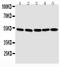 SMAD Family Member 1 antibody, PA2114, Boster Biological Technology, Western Blot image 