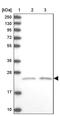 Potassium voltage-gated channel subfamily G member 1 antibody, PA5-58828, Invitrogen Antibodies, Western Blot image 