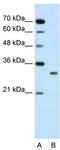 Ribosome maturation protein SBDS antibody, TA338055, Origene, Western Blot image 