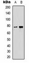 Nipsnap Homolog 3A antibody, orb75111, Biorbyt, Western Blot image 