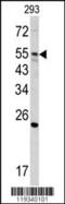 Glucosamine (N-Acetyl)-6-Sulfatase antibody, 62-335, ProSci, Western Blot image 