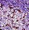 Neurofibromin 1 antibody, orb322990, Biorbyt, Immunohistochemistry paraffin image 