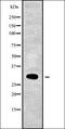 Centromere protein Q antibody, orb337857, Biorbyt, Western Blot image 