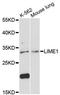 Lck Interacting Transmembrane Adaptor 1 antibody, LS-C748754, Lifespan Biosciences, Western Blot image 