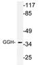 Gamma-Glutamyl Hydrolase antibody, AP21177PU-N, Origene, Western Blot image 