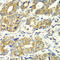 Dihydrolipoamide S-Succinyltransferase antibody, 14-898, ProSci, Immunohistochemistry frozen image 