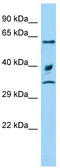 E3 ubiquitin-protein ligase ARIH2 antibody, TA344534, Origene, Western Blot image 