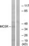 Melanocortin 5 Receptor antibody, TA314182, Origene, Western Blot image 