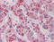 NDRG Family Member 2 antibody, 30-339, ProSci, Immunohistochemistry paraffin image 