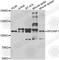 RPGR Interacting Protein 1 antibody, A7477, ABclonal Technology, Western Blot image 