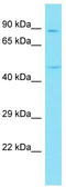 Coiled-Coil Domain Containing 13 antibody, TA334791, Origene, Western Blot image 