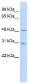 Dihydroorotate Dehydrogenase (Quinone) antibody, TA346289, Origene, Western Blot image 