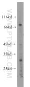 UTP3 Small Subunit Processome Component antibody, 18886-1-AP, Proteintech Group, Western Blot image 