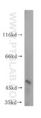 Septin 11 antibody, 14672-1-AP, Proteintech Group, Western Blot image 