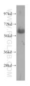 Serine palmitoyltransferase 2 antibody, 51012-2-AP, Proteintech Group, Western Blot image 