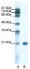 SSX Family Member 2B antibody, TA331475, Origene, Western Blot image 