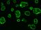 Tumor Associated Calcium Signal Transducer 2 antibody, 10428-T26, Sino Biological, Immunohistochemistry paraffin image 