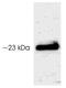 Serotonin N-acetyltransferase antibody, GTX23439, GeneTex, Western Blot image 
