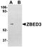 Zinc Finger BED-Type Containing 3 antibody, orb75175, Biorbyt, Western Blot image 