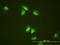 Stem-Loop Binding Protein antibody, LS-C198508, Lifespan Biosciences, Immunofluorescence image 