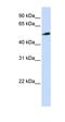 Pyridine Nucleotide-Disulphide Oxidoreductase Domain 2 antibody, orb325669, Biorbyt, Western Blot image 