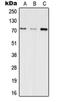 Inositol Polyphosphate-5-Phosphatase E antibody, orb215580, Biorbyt, Western Blot image 