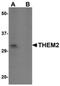 Acyl-CoA Thioesterase 13 antibody, PA5-20777, Invitrogen Antibodies, Western Blot image 