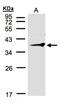 Ring Finger Protein 2 antibody, NBP1-31048, Novus Biologicals, Western Blot image 