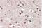 Metabotropic glutamate receptor 2 antibody, NBP1-68855, Novus Biologicals, Immunohistochemistry frozen image 