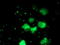 Phosphoglycerate Mutase 2 antibody, TA503401, Origene, Immunofluorescence image 