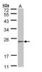 NADH:Ubiquinone Oxidoreductase Complex Assembly Factor 4 antibody, orb74245, Biorbyt, Western Blot image 