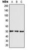 Solute Carrier Family 2 Member 4 antibody, LS-C354081, Lifespan Biosciences, Western Blot image 