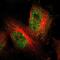 BCL6 Transcription Repressor antibody, NBP2-59786, Novus Biologicals, Immunofluorescence image 