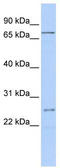 Polypeptide N-Acetylgalactosaminyltransferase 14 antibody, TA338661, Origene, Western Blot image 