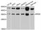 Ribosomal Protein S6 antibody, STJ27852, St John