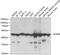 ATP Synthase F1 Subunit Beta antibody, GTX30075, GeneTex, Western Blot image 