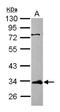 ETV7 antibody, NBP2-16388, Novus Biologicals, Western Blot image 