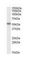 Forkhead box protein C2 antibody, ab5060, Abcam, Western Blot image 