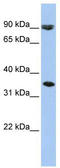 Solute Carrier Family 10 Member 7 antibody, TA334136, Origene, Western Blot image 