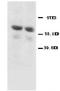 Glutamate Decarboxylase 2 antibody, LS-C312569, Lifespan Biosciences, Western Blot image 