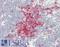 CD20 antibody, LS-B12186, Lifespan Biosciences, Immunohistochemistry paraffin image 