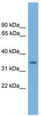 NK3 Homeobox 2 antibody, TA341749, Origene, Western Blot image 