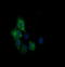 Cancer/Testis Antigen 1B antibody, LS-C174582, Lifespan Biosciences, Immunofluorescence image 