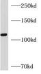 Adaptor Related Protein Complex 3 Subunit Delta 1 antibody, FNab00465, FineTest, Western Blot image 