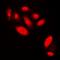 Androgen Receptor antibody, orb338855, Biorbyt, Immunofluorescence image 
