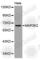 Mitogen-activated protein kinase kinase kinase 2 antibody, A2611, ABclonal Technology, Western Blot image 